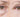 Say Goodbye to Puffy Eyes, Dark Circles, and Crow’s Feet