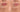 Get Rid of Dark Lips: Causes, Lifestyle Tips, and Natural Solutions