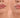 Get Rid of Dark Lips: Causes, Lifestyle Tips, and Natural Solutions